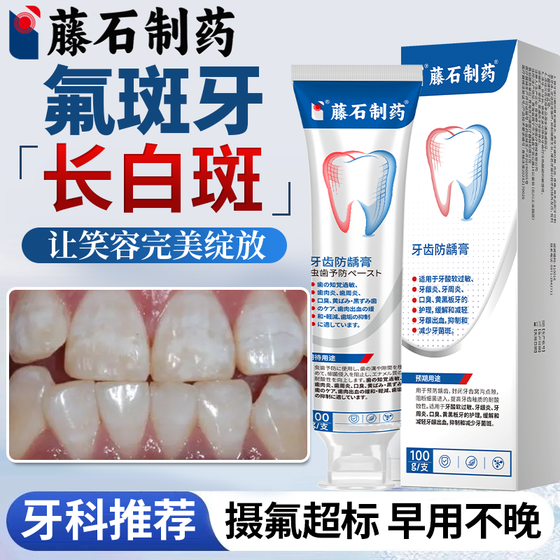 氟斑牙去除专用可搭牙膏用稀盐酸擦剂儿童牙齿祛牙菌斑变白神器OZ