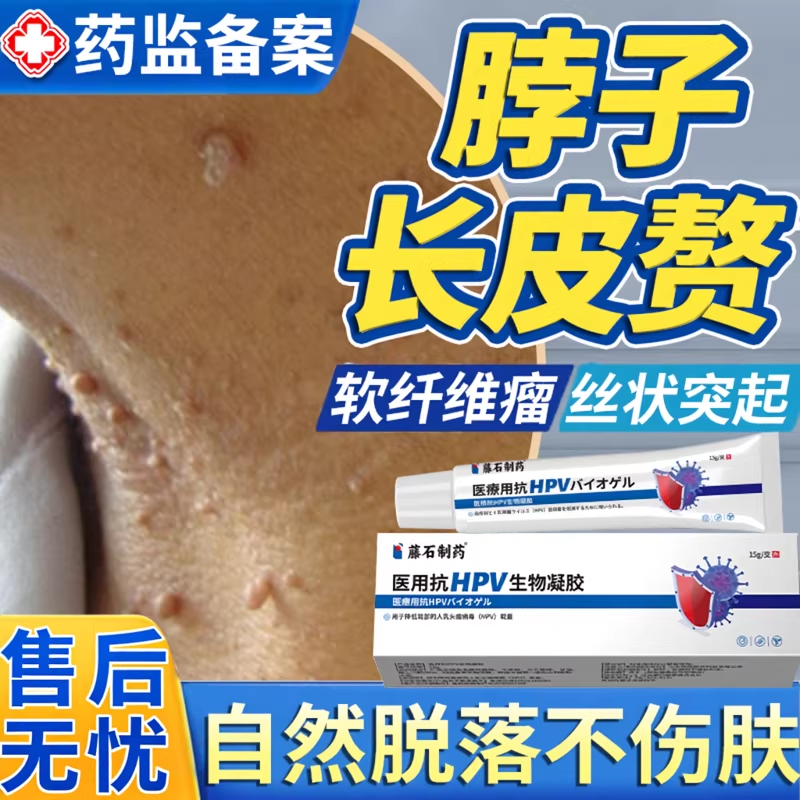 皮赘膏去除神器软组织纤维瘤脖子上脂肪粒腋下小肉粒药房同款膏BS