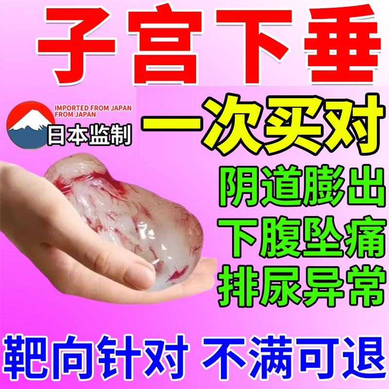 子宫脱垂子宫下垂中药贴训练器医用可搭治疗仪拖托阴道前壁膨出bs