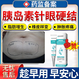 血糖高人打针硬块消肿胰岛素针眼消硬结鼓硬包皮肤修护理复软膏OZ