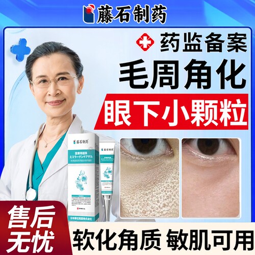 眼周毛周角化膏敏感肌可用