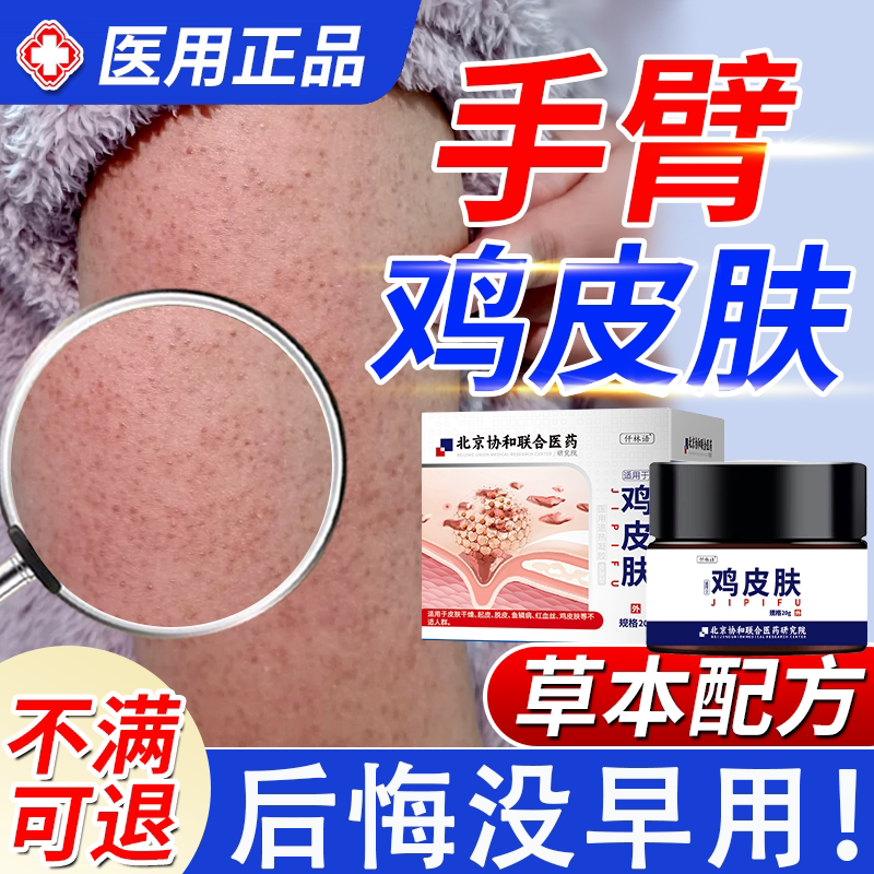 去鸡皮肤毛囊炎磨砂膏手臂胳膊上长疙瘩毛囊角化沐浴露儿童jw
