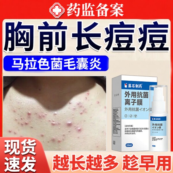胸前前胸后背长痘痘毛囊炎背上胸口背后马拉色菌药房款膏喷雾剂JW