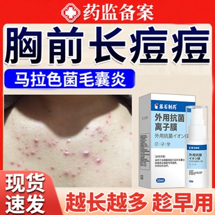 胸前前胸后背长痘痘毛囊炎背上胸口背后马拉色菌药房款膏喷雾剂JW