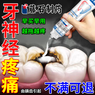 牙髓炎专用杀牙神经疼痛特牙齿疼效止疼漱口水药房款牙喷雾剂膏DZ