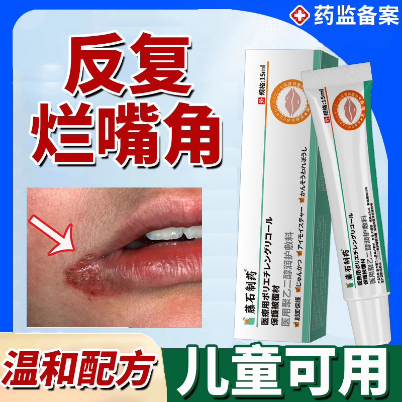 口角炎烂嘴角开裂溃疡专用唇炎可搭膏药贴疱疹儿童嘴巴上火起泡JW
