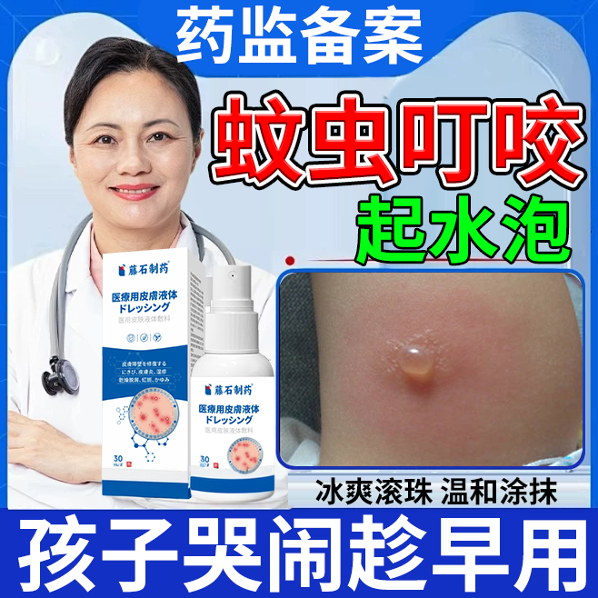 儿童蚊虫叮咬起水泡毒蚊子药房同款止痒膏消芦荟炎快速消肿专用OZ
