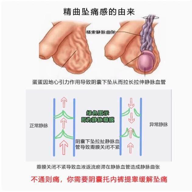 内裤医纯色透气男士阴囊托带提睾防潮分离四角裤