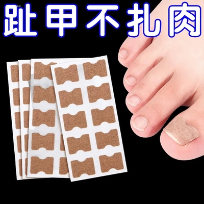 甲沟矫正器嵌甲脚趾甲长到肉里贴片正甲扣纠正神器指甲卷甲专用炎