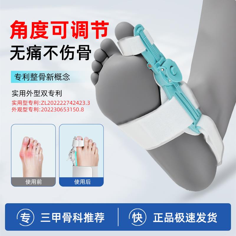 脚趾矫正器拇指外翻分趾器纠正大拇足脚趾头大脚骨突出男女通用