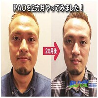 美容仪器神器物理棒日本瘦去双下巴瘦咬肌苹果肌法令纹v脸瘦脸