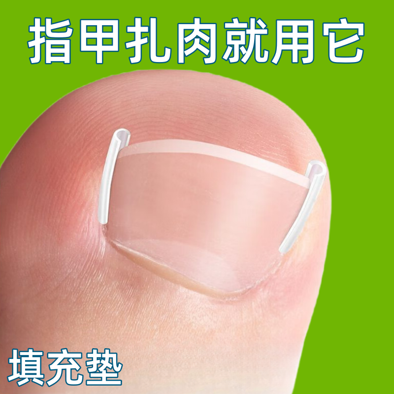 甲沟炎修复纠正器专用嵌甲垫片纠正隔离大脚趾不扎肉神器,居家日用,居家日用套装,淘宝优惠券,粉丝福利购,淘宝优惠卷