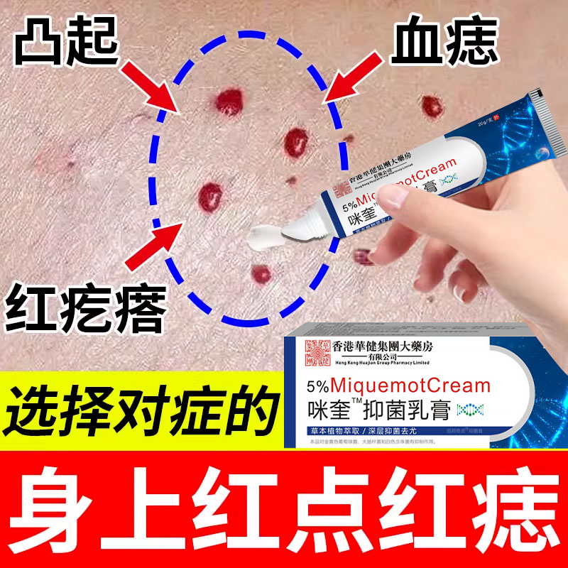 去除血管痣小红点樱桃状瘤