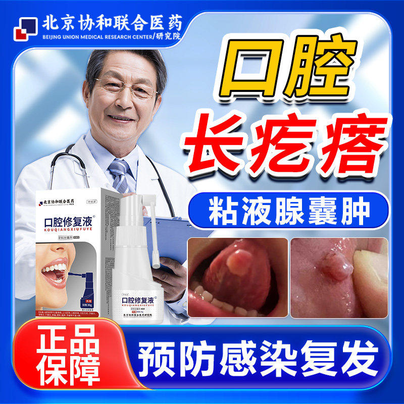口腔长息肉口腔肉芽肿肉瘤疙瘩舌下粘液腺囊肿溃疡唾液滤泡WX
