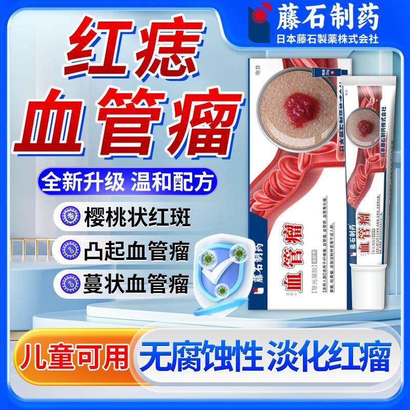 血管瘤痣搭普萘洛尔软膏去