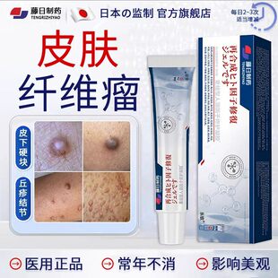 日系制药皮肤纤维瘤膏非消瘤膏乳腺贴囊肿脂肪瘤皮下粉瘤硬疙瘩bl