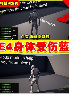 UE4 Limb Based Health System人物身体部位受伤生命健康蓝图4.27