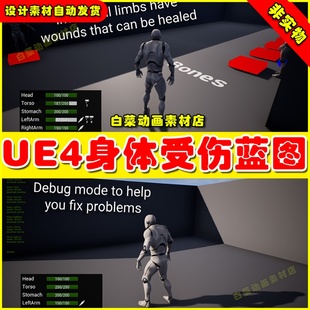 Health Based System人物身体部位受伤生命健康蓝图4.27 Limb UE4