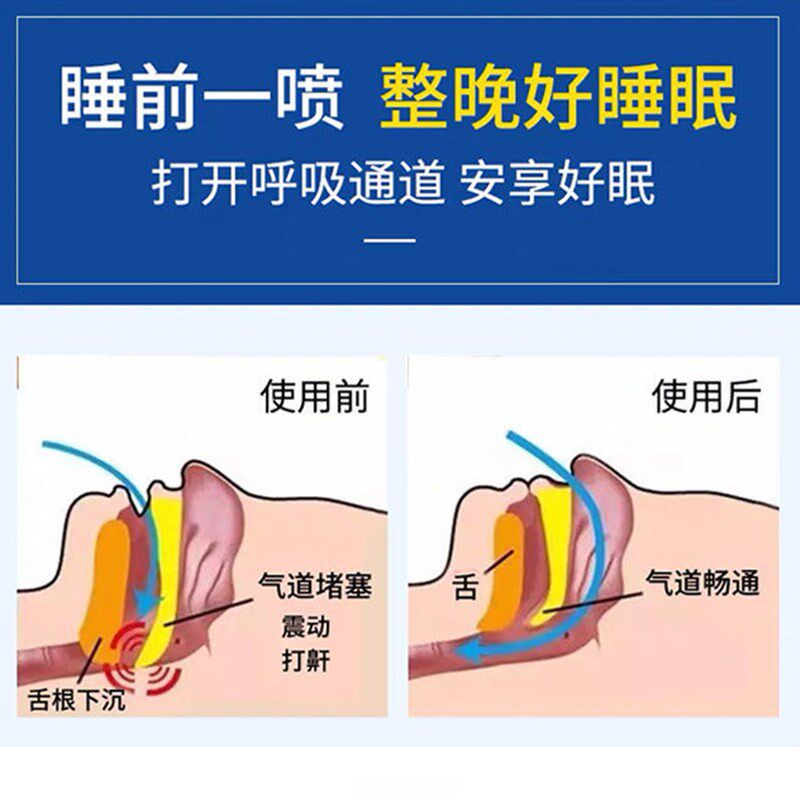极速云南本草防鼾器o鼾立停神器防打呼打鼾止鼾喷剂家用的药治打