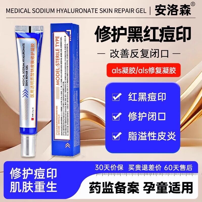 ADN凝胶ALS鼻翼泛红祛痘印闭口als凝胶安洛森缩毛孔粗大屏障受损