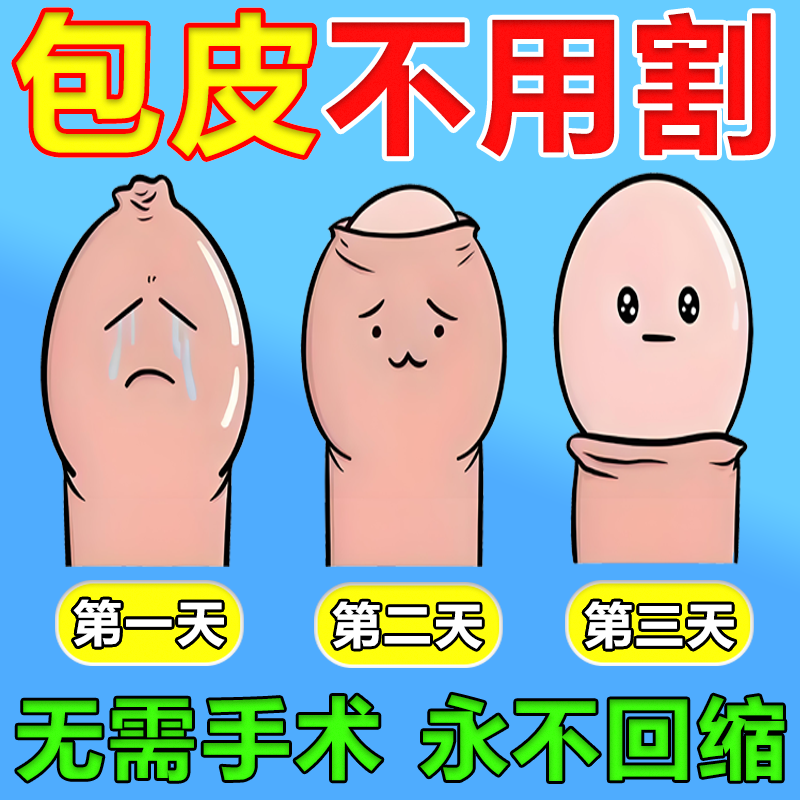 日本川井包皮阻复环外翻切除器脱落矫正男用隐形包茎凝胶医用过长