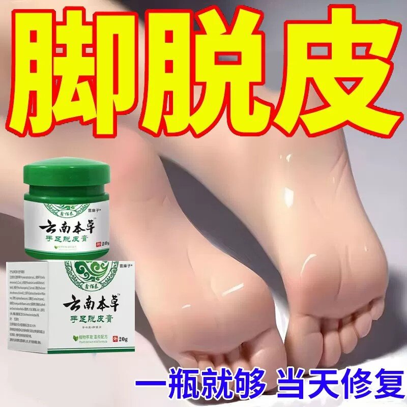 脚掌脱皮脚底脚心掉皮脱皮专膏用脚皮肤粗糙干燥干裂去除老茧根药