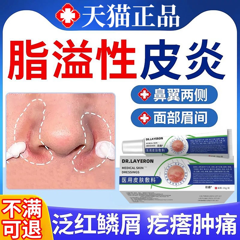 鼻翼脂溢性皮炎面部面霜软膏鼻子两侧发红脸上皮肤干燥起皮脱皮痛
