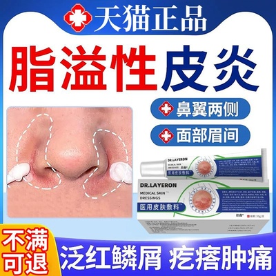 鼻翼脂溢性皮炎面部面霜软膏鼻子两侧发红脸上皮肤干燥起皮脱皮痛