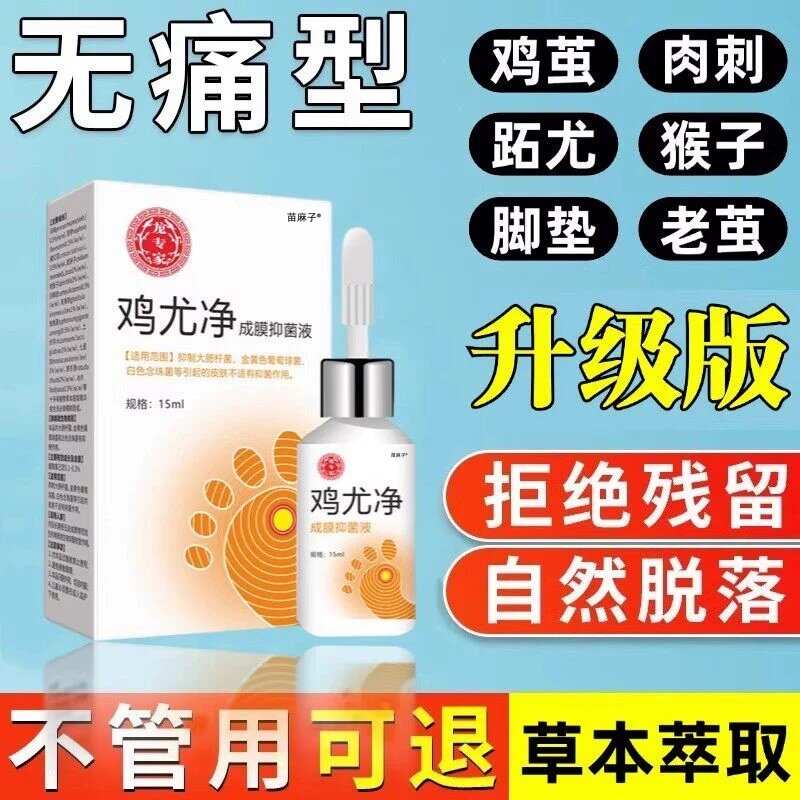 鸡尤净鸡眼药水肉刺疣扁平去除药膏一抹灵去鸡眼膏贴尤跖根用专膏