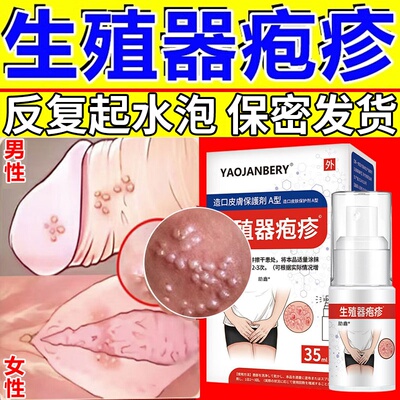 男士生殖器疱疹断药根阴茎真菌感染病毒特膏效日本药喷剂