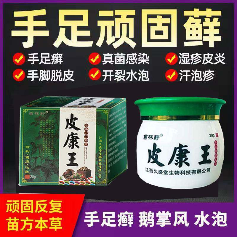 汗疱疹专用手上长水泡脚上长水泡脱皮手癣手气脚气真菌感染止痒膏