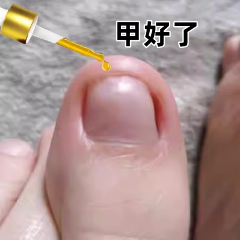 【热】7天换钾护足霜