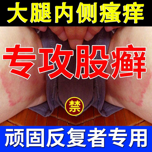 股藓大腿内侧瘙痒疹专用
