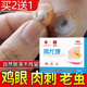 鸡尤康贴脚老茧去除肉刺鸡眼膏疣药膏扁平疣瘊子尤瘊小肉粒神器