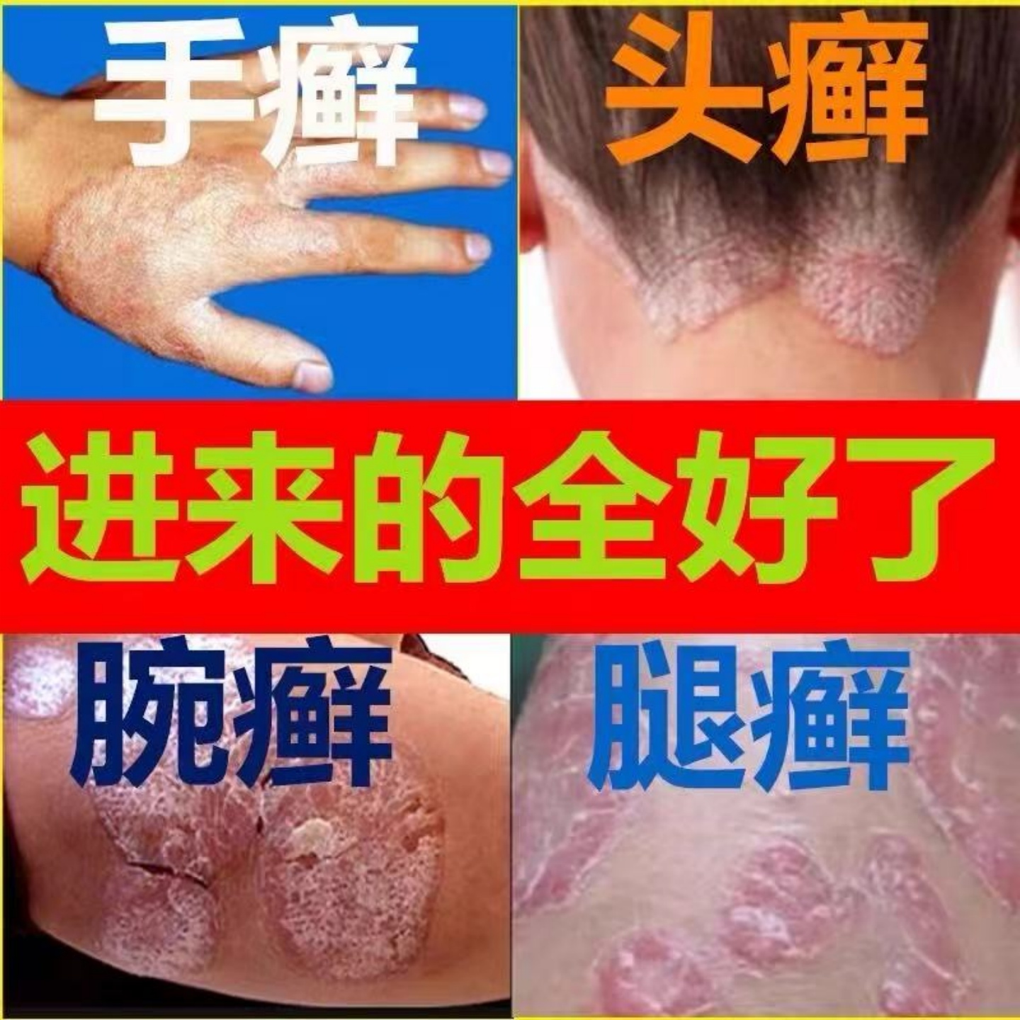 大腿内侧瘙痒【救星膏】