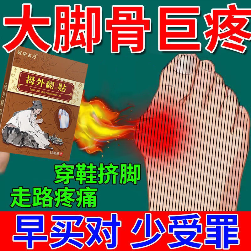 【一夜直】拇指外翻矫正保健护具