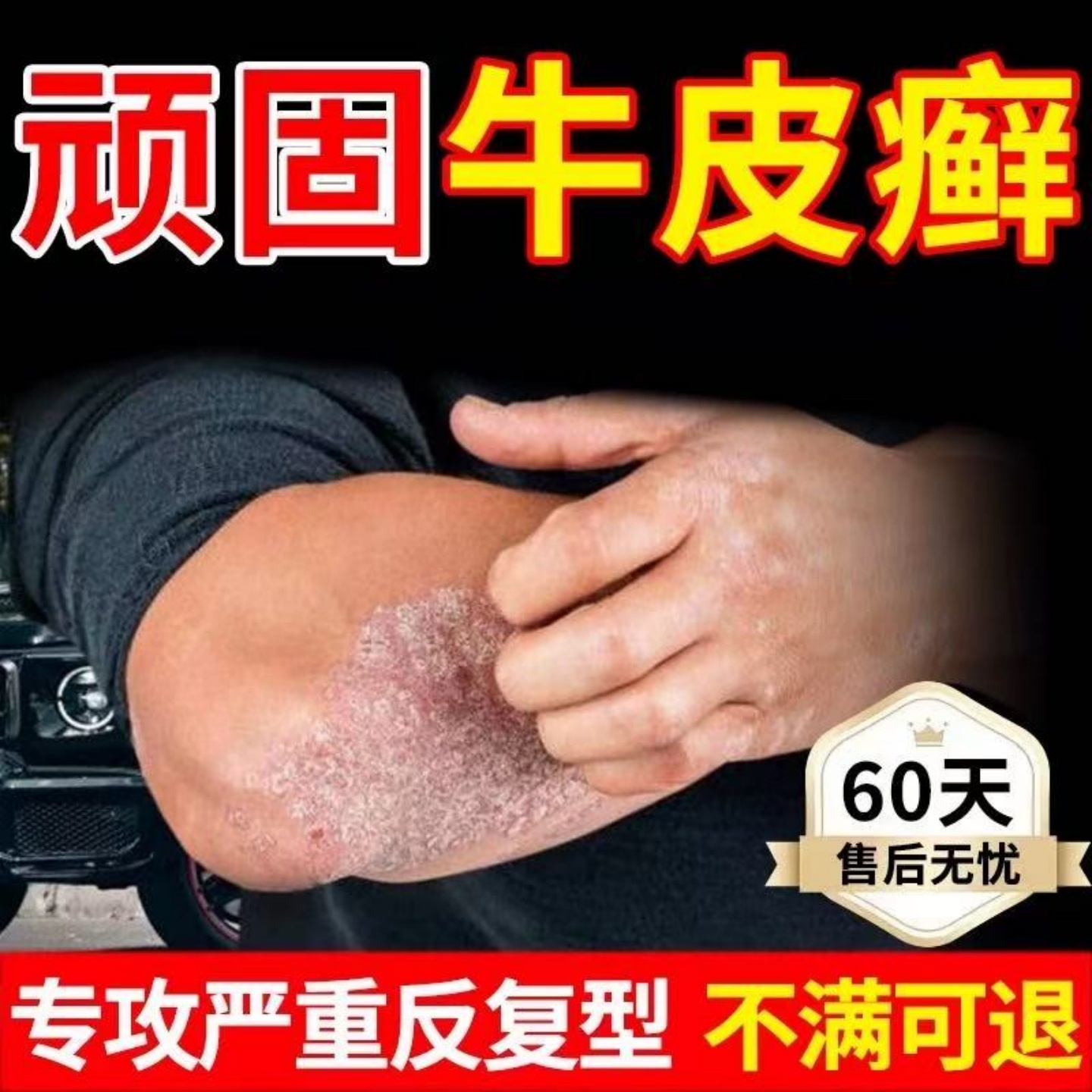 香港大药房【牛藓王救星】