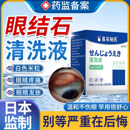 【医用级】眼结石清洗液