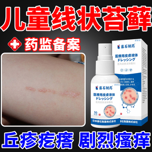 儿童线状性苔藓皮肤病扁平苔藓化专用小疙瘩多型红斑药房同款膏DZ