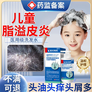儿童头皮屑脂溢性皮炎真菌感染头癣医用级毛囊炎糠疹专用洗发水JW
