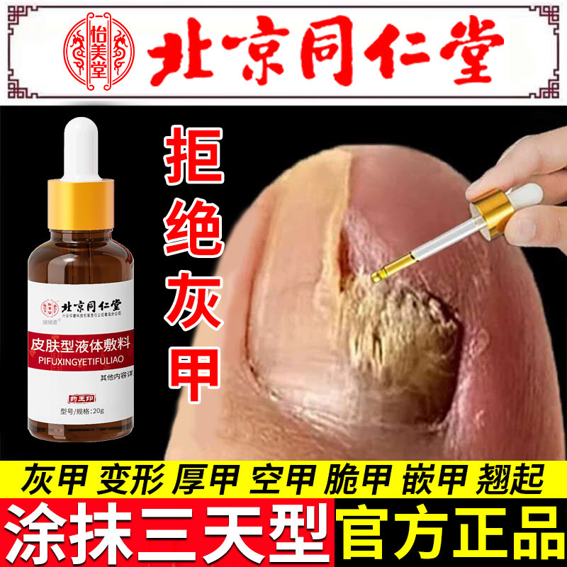灰指甲专用浑浊甲沟炎冰醋酸30抗真菌指甲剪刀正品旗舰店药膏HT