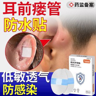 耳前瘘管防水贴耳朵洗澡洗头游泳防进水清理工具成人儿童护耳贴QF