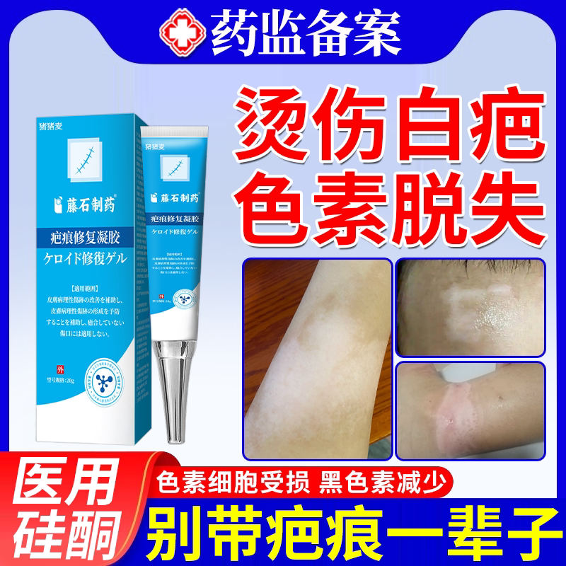 油烫伤烧伤白色疤痕色素脱失修复专用除疤去疤凝胶祛疤膏旗舰店JW