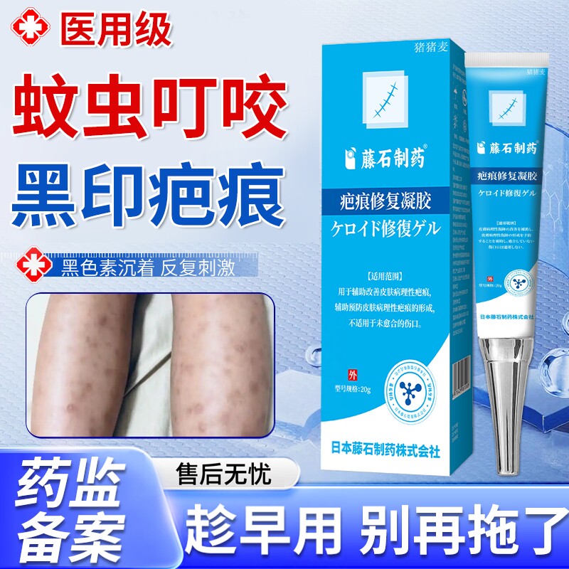 蚊虫叮咬祛疤膏去黑印黑色素沉淀儿童被蚊子咬留疤淡化修复疤痕EM
