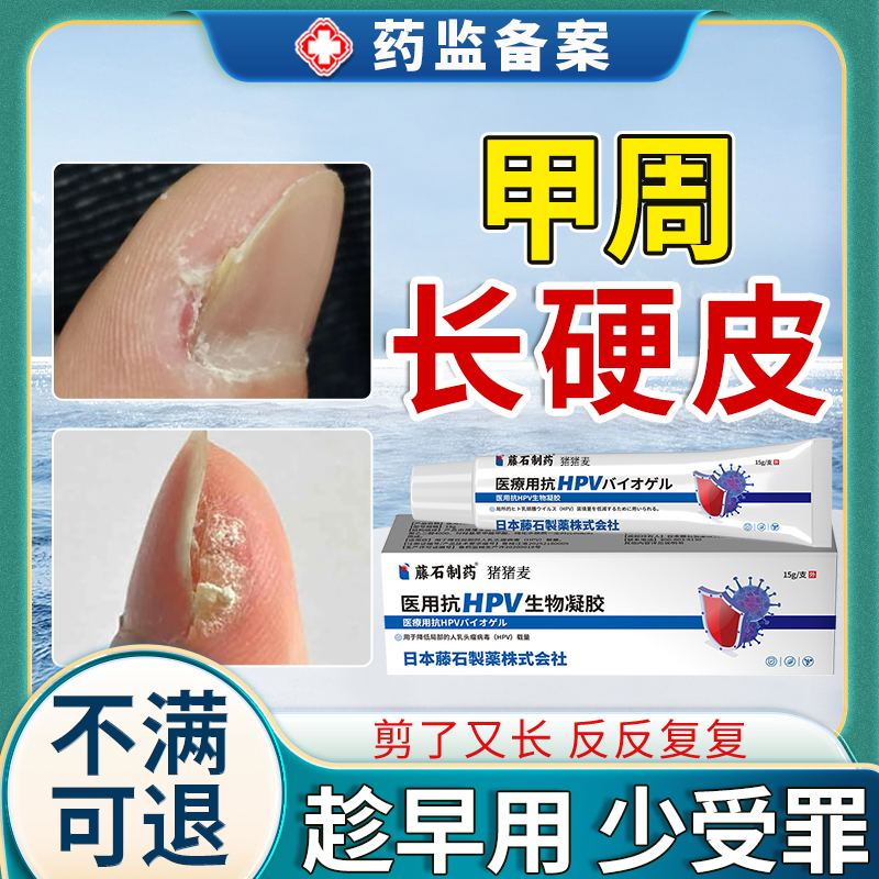 甲周疣指甲指甲周围长硬皮