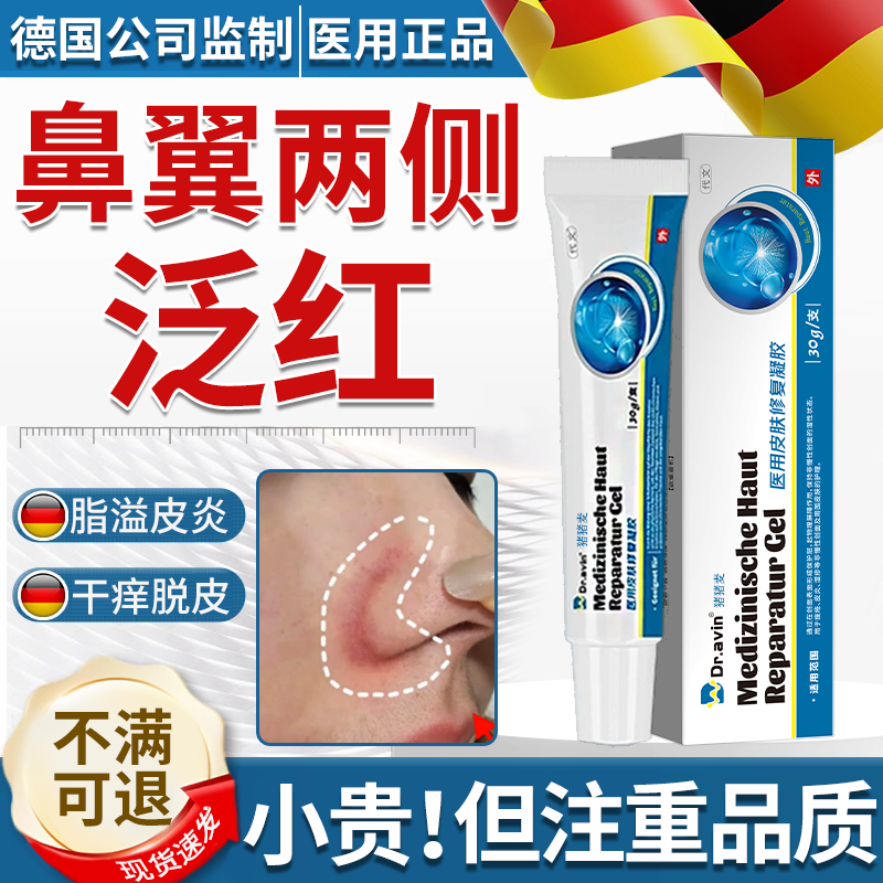【德国公司监制】脂溢性皮炎凝胶