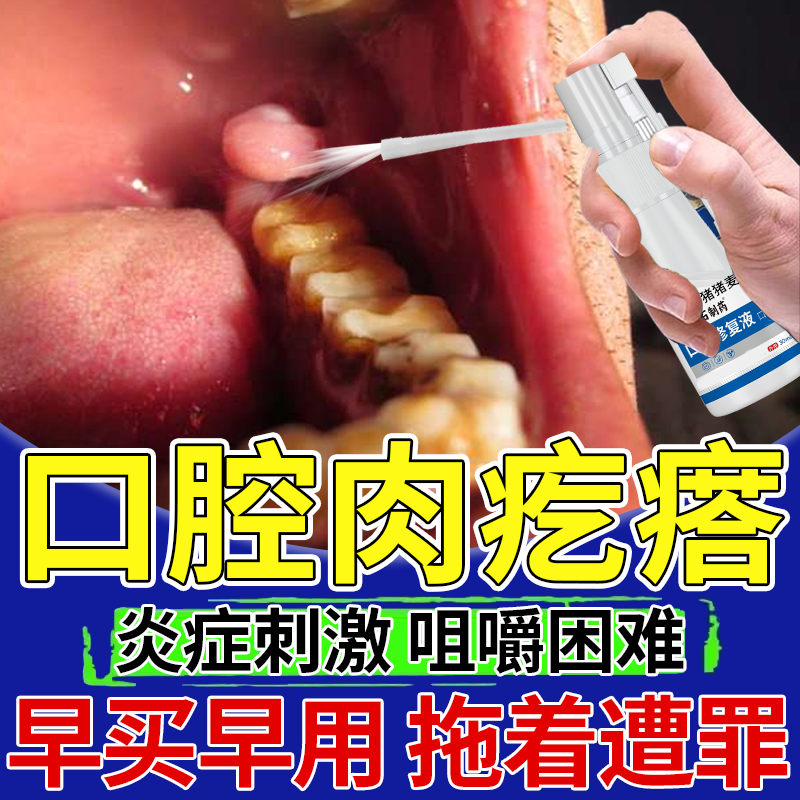 口腔息肉去除内壁长肉疙瘩乳头状瘤泡疹唾液粘液腺囊肿修牙龈OZ