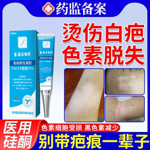 油烫伤烧伤白色疤痕色素脱失修复专用除疤去疤凝胶祛疤膏旗舰店JW