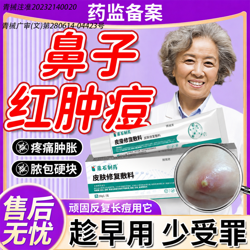 鼻子上长痘痘去红鼻头鼻尖上火红肿火疖子脓包毛囊炎肉疙瘩痤疮MP