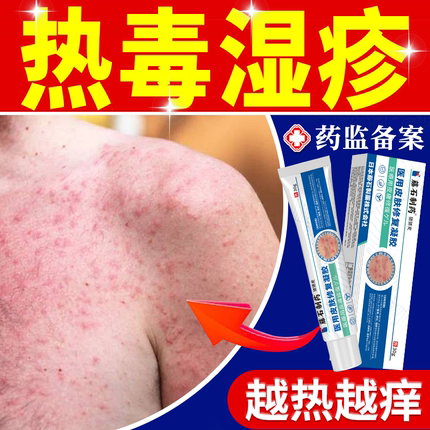 热毒湿疹皮肤一热就痒血热皮肤痒水泡去专用根湿毒清除湿止痒膏JW